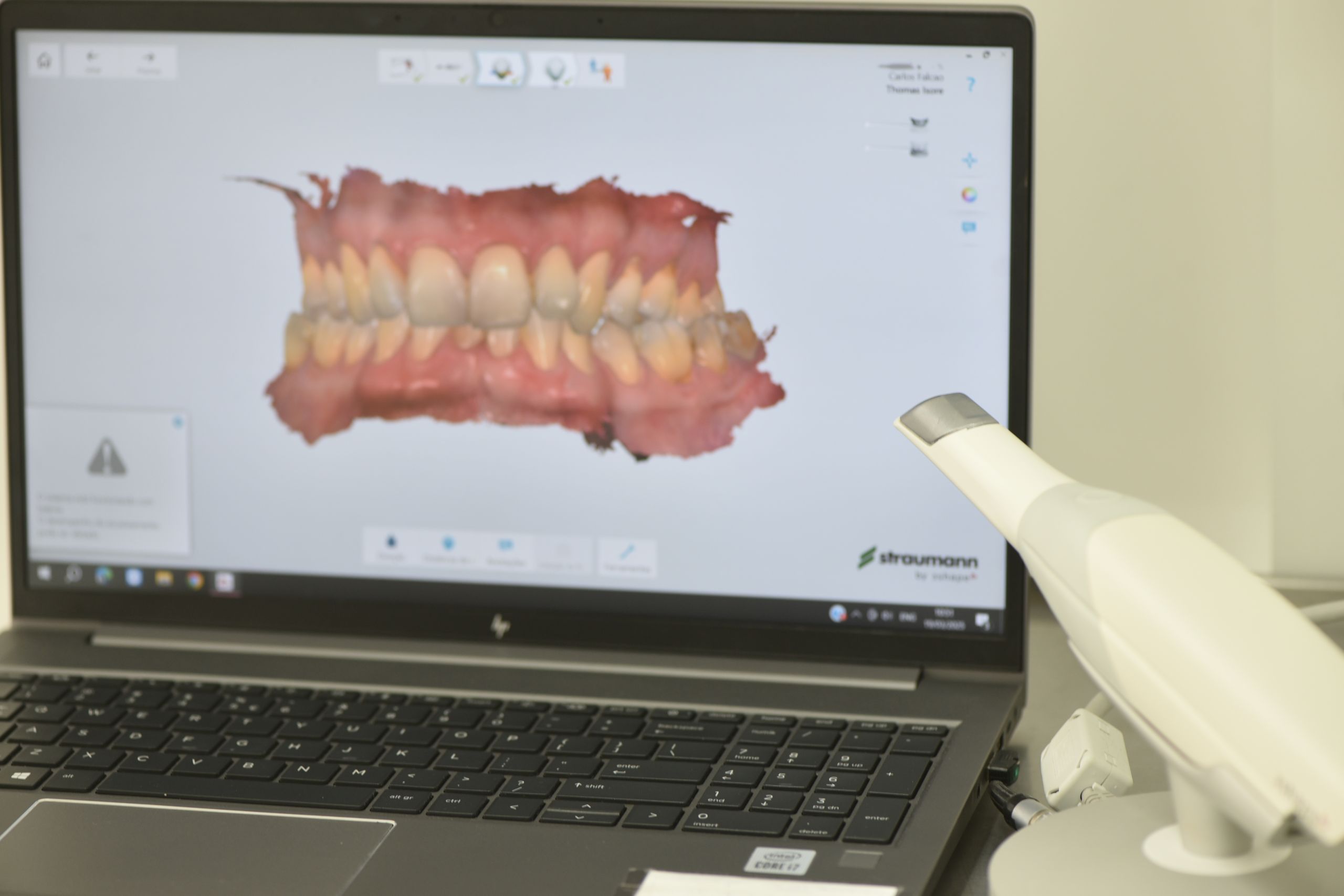 Scanner Intraoral - Porto Dental Institute