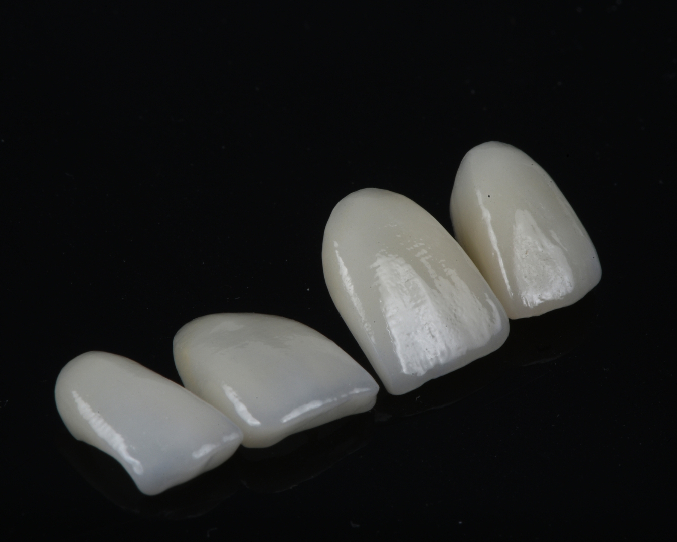 Facetas Dentárias Detalhe