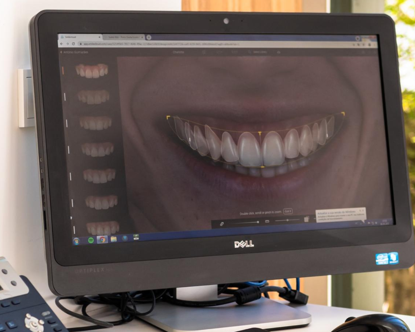 Digital Smile Design - Porto Dental Institute