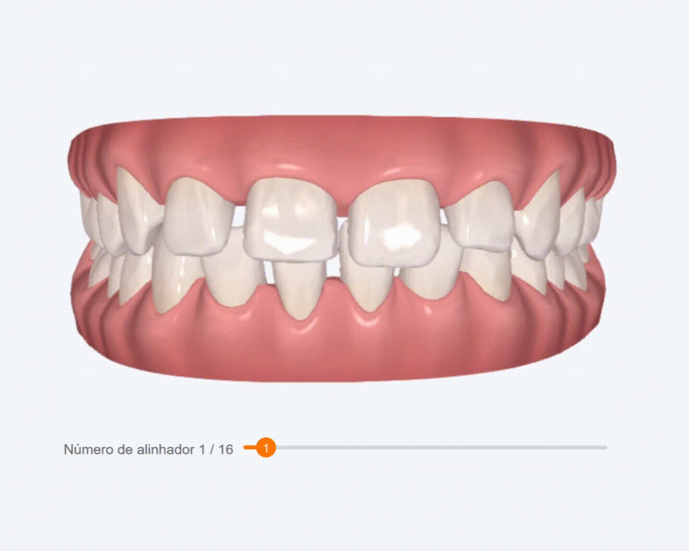 Planeamento 3D Ortodontia